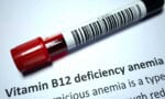 Vitamin B12 Deficiency A Preventable Consequence of Metformin Therapy