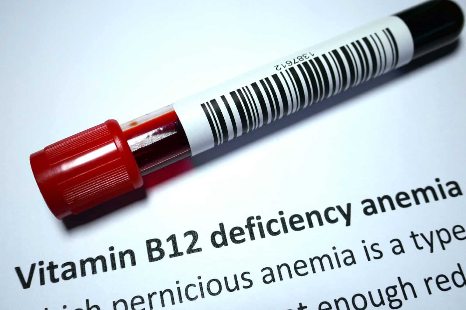 Vitamin B12 Deficiency A Preventable Consequence of Metformin Therapy