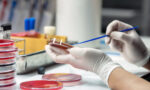 Top 5 Lab Test Result Interpretation Mistakes (and How to Avoid Them)