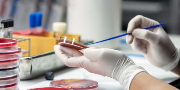 5 Lab Tests Every Nurse Practitioner Should Monitor During Common Medication Therapies