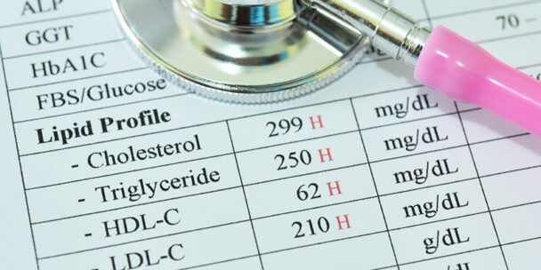 Dyslipidemia in Adults: Diagnosis, Treatment, and Management