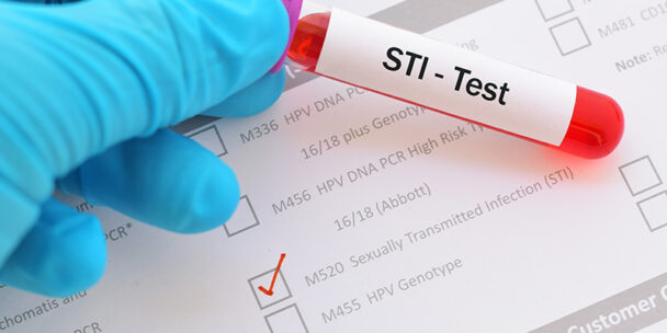 STI Cases in the United States Continue to Escalate