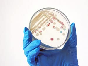 Colder Weather Sees Increase in Vibrio Infections