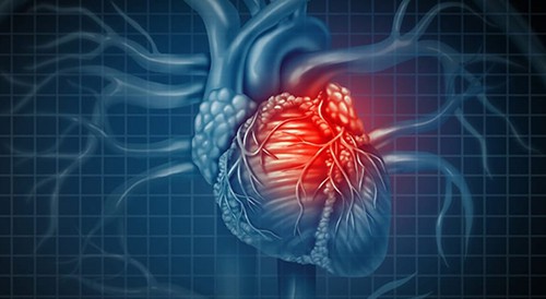 FDA Approved Semaglutide Injection to Reduce Risk of Serious Heart Problems in Overweight Adults