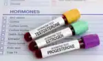 The NP’s Expanding Role in HRT: Get Certified and Unlock New Opportunities